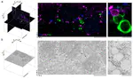 Permeabilization-free en bloc immunohistochemistry for correlative microscopy