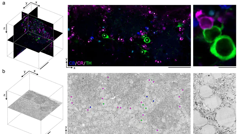 Permeabilization-free en bloc immunohistochemistry for correlative microscopy